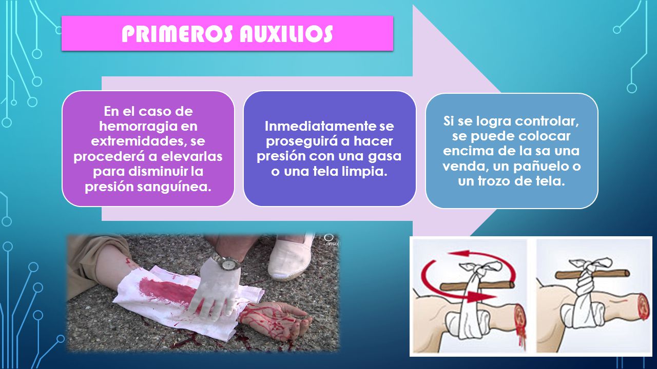 En el caso de hemorragia en extremidades, se procederá a elevarlas para disminuir la presión sanguínea.
