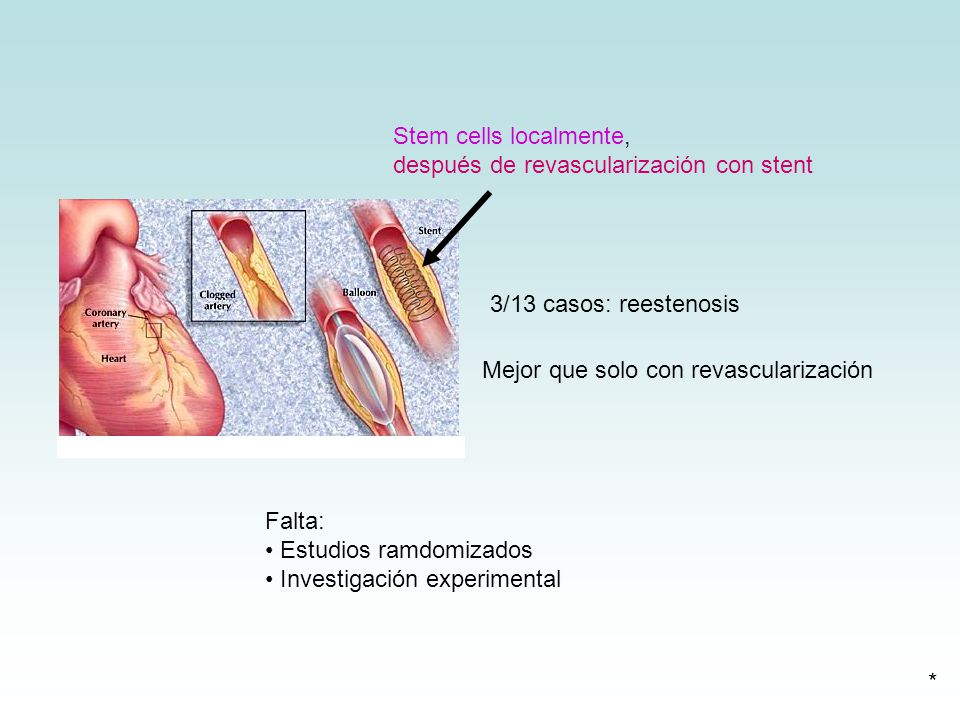 Stem cells localmente, después de revascularización con stent. 3/13 casos: reestenosis. Mejor que solo con revascularización.