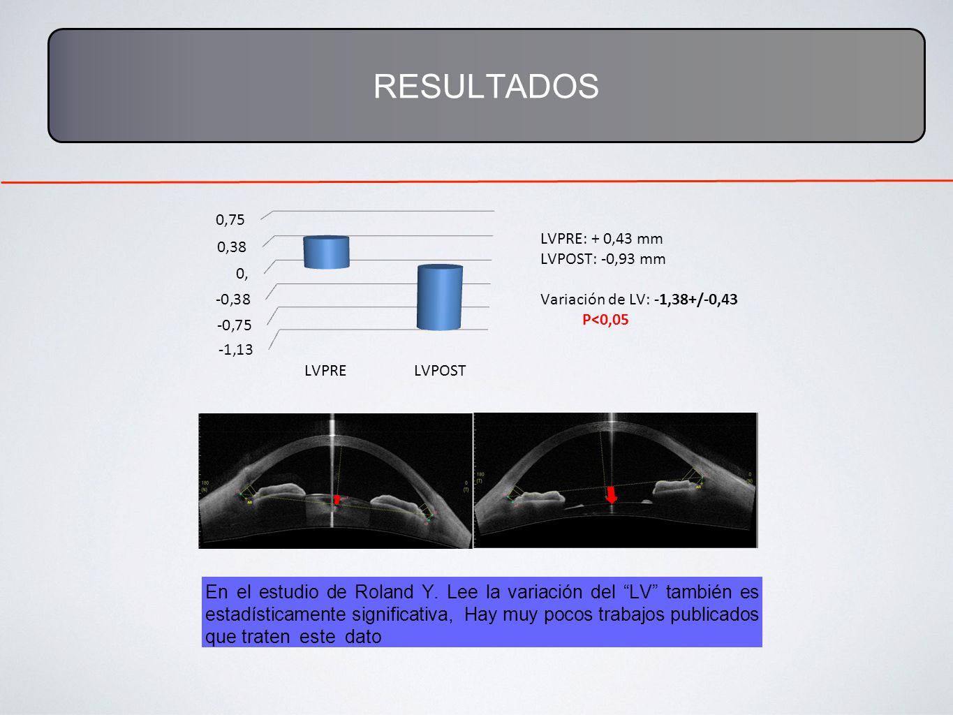 RESULTADOS LVPRE: + 0,43 mm. LVPOST: -0,93 mm. Variación de LV: -1,38+/-0,43. P<0,05.