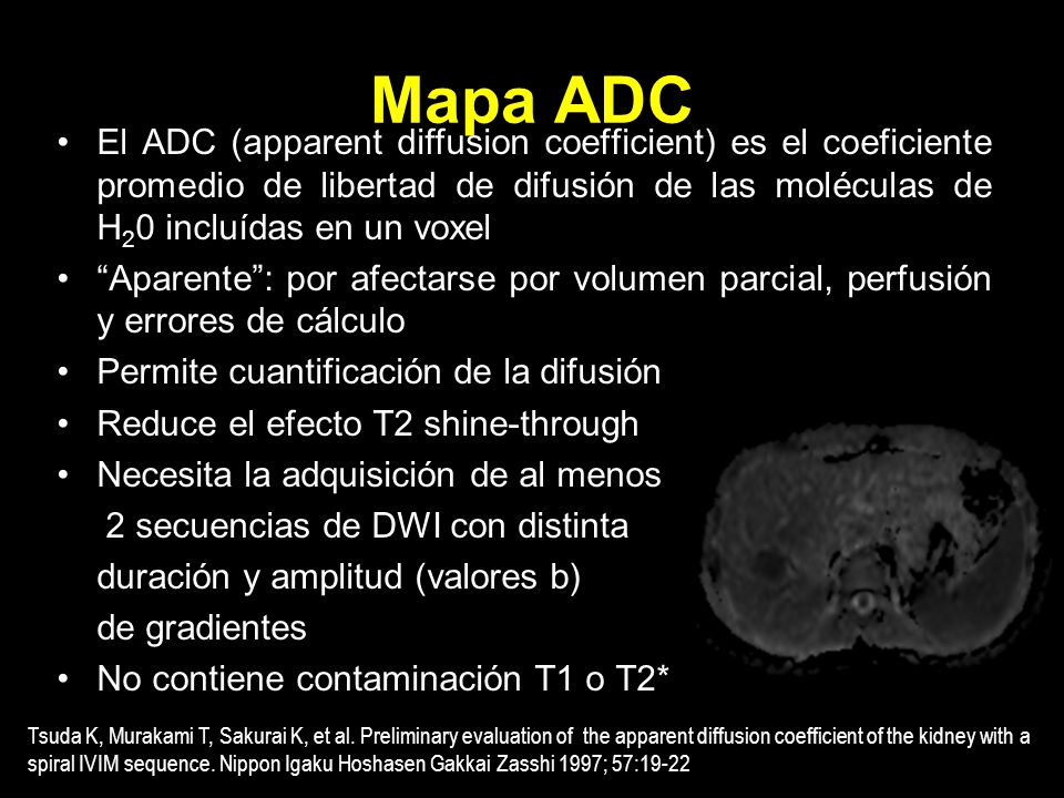 Mapa ADC El ADC (apparent diffusion coefficient) es el coeficiente promedio de libertad de difusión de las moléculas de H20 incluídas en un voxel.