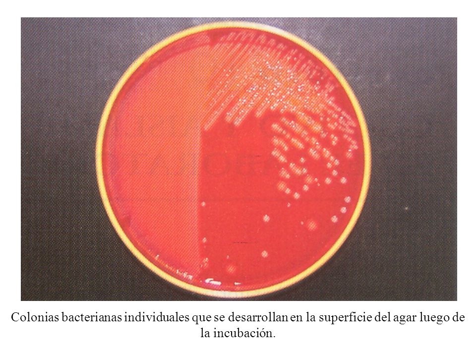 Colonias bacterianas individuales que se desarrollan en la superficie del agar luego de la incubación.