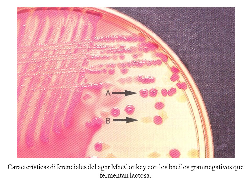 Características diferenciales del agar MacConkey con los bacilos gramnegativos que fermentan lactosa.