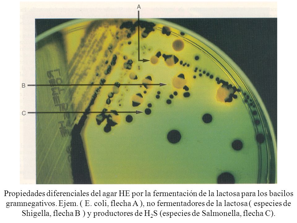 Propiedades diferenciales del agar HE por la fermentación de la lactosa para los bacilos gramnegativos.