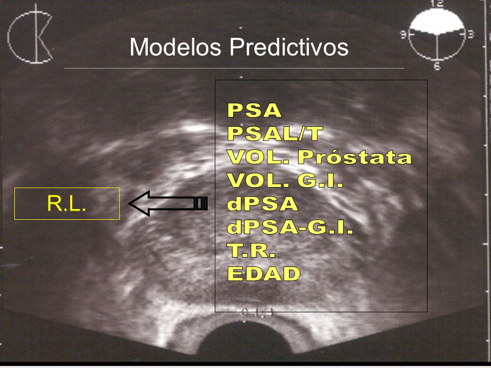 Modelos Predictivos R.L. PSA PSAL/T VOL. Próstata VOL. G.I. dPSA