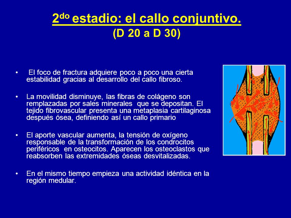 2do estadio: el callo conjuntivo. (D 20 a D 30)