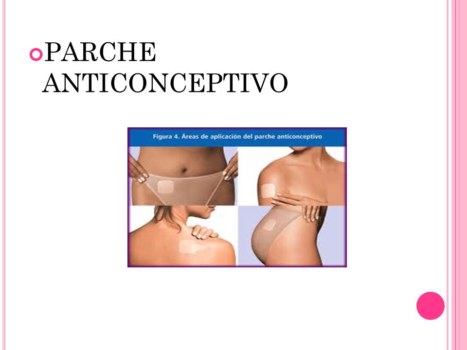 PARCHE ANTICONCEPTIVO