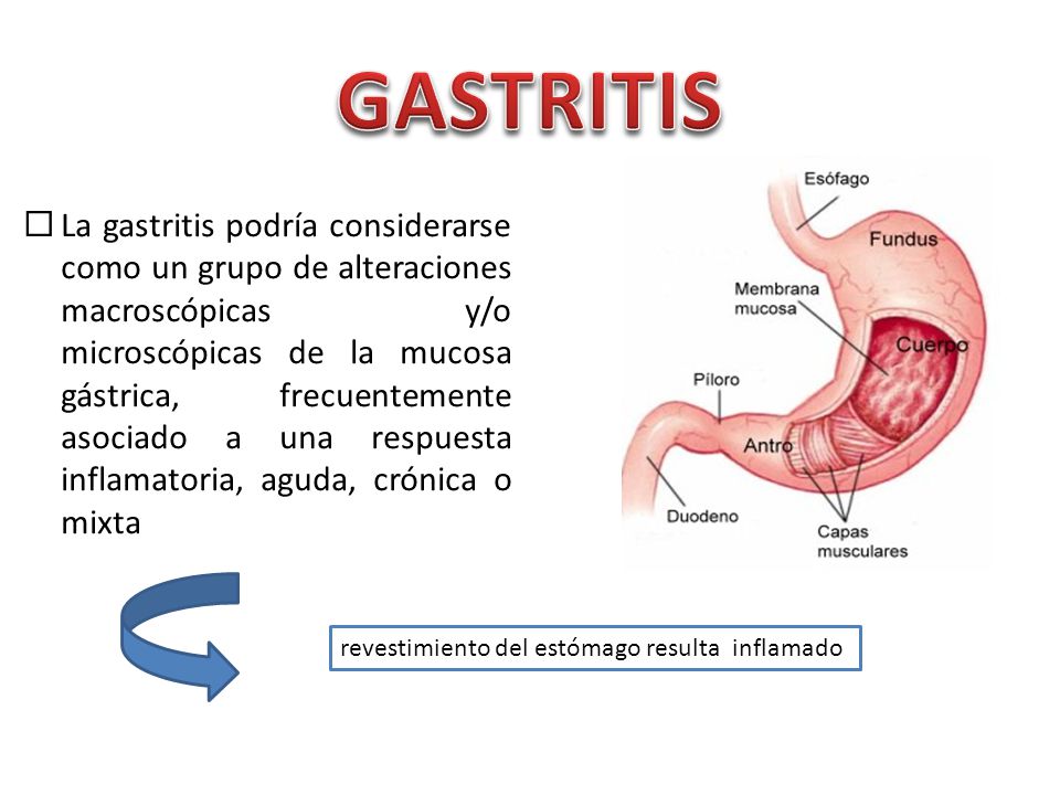 GASTRITIS