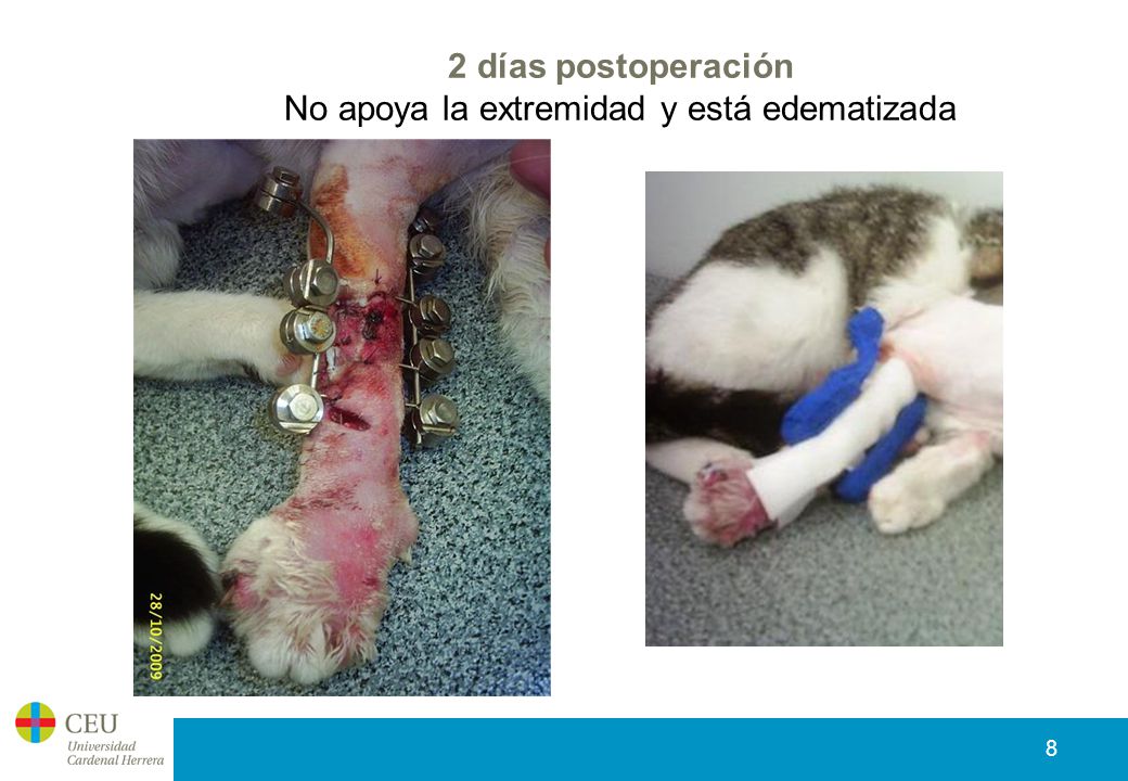2 días postoperación No apoya la extremidad y está edematizada
