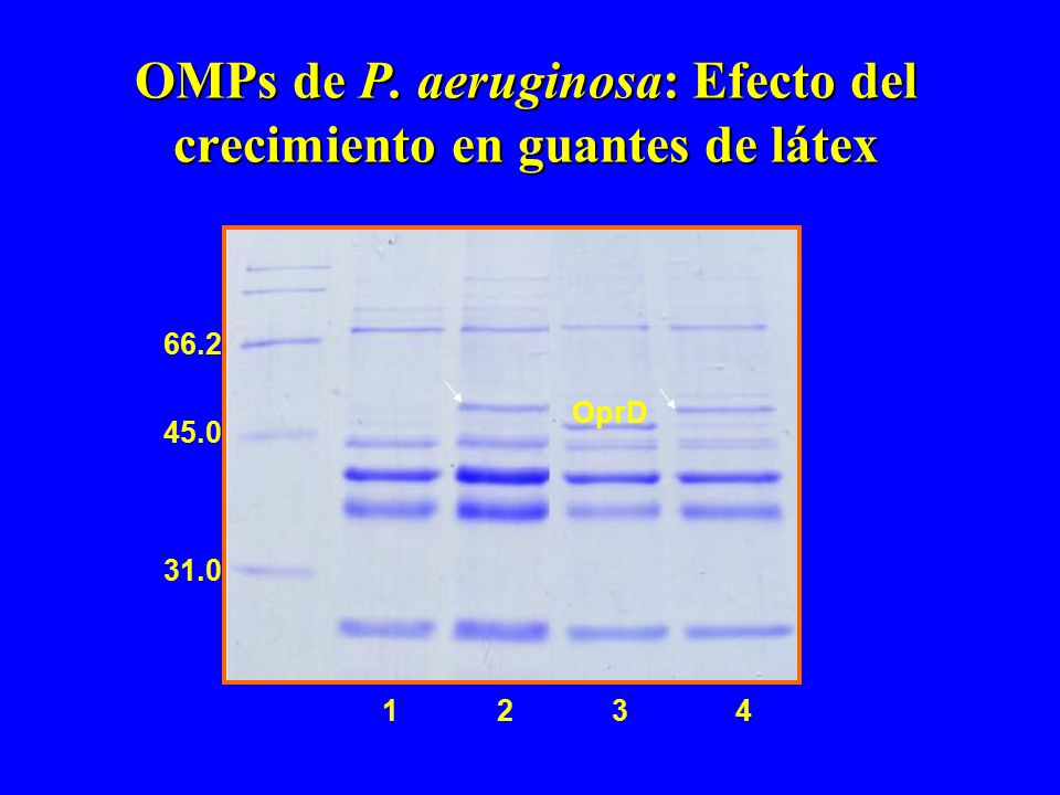 OMPs de P. aeruginosa: Efecto del crecimiento en guantes de látex