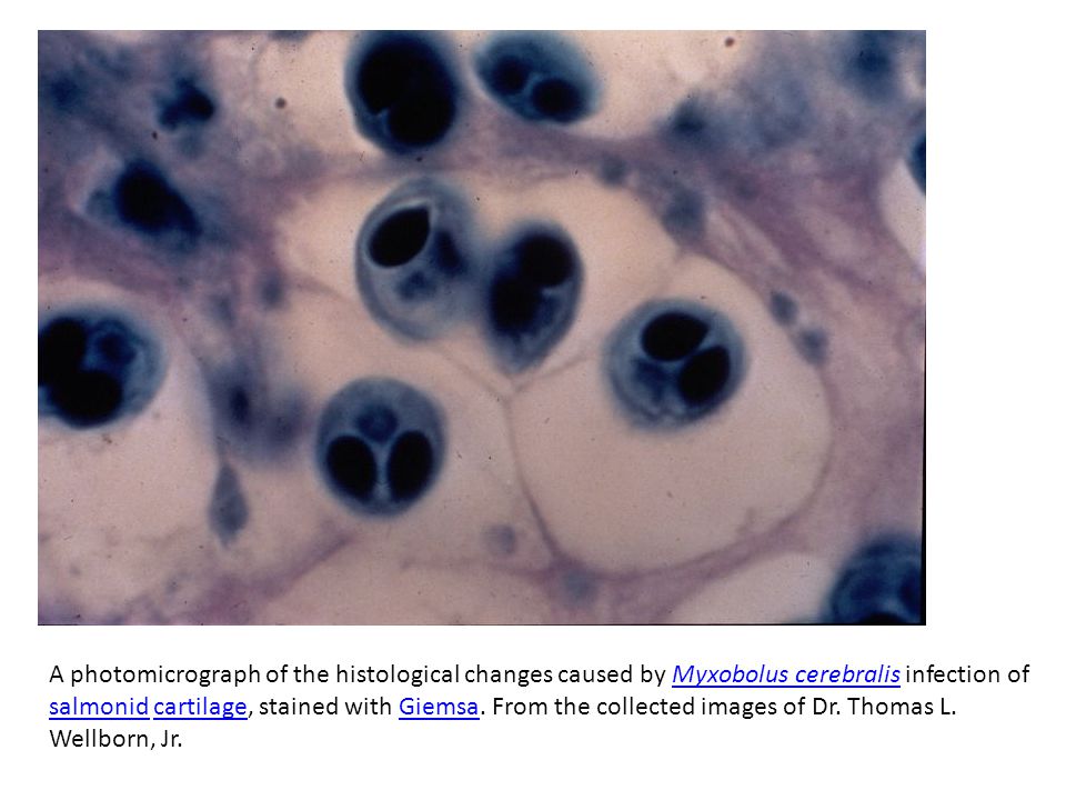 A photomicrograph of the histological changes caused by Myxobolus cerebralis infection of salmonid cartilage, stained with Giemsa.