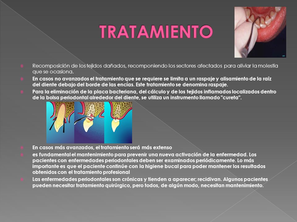 TRATAMIENTO Recomposición de los tejidos dañados, recomponiendo los sectores afectados para aliviar la molestia que se ocasiona.