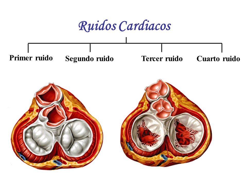 Ruidos Cardiacos Cuarto ruido Segundo ruido Tercer ruido Primer ruido