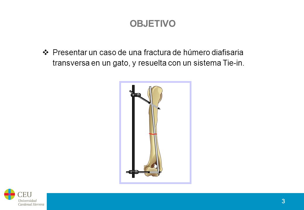OBJETIVO Presentar un caso de una fractura de húmero diafisaria transversa en un gato, y resuelta con un sistema Tie-in.