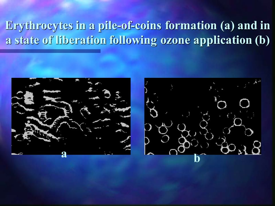 Erythrocytes in a pile-of-coins formation (a) and in a state of liberation following ozone application (b)