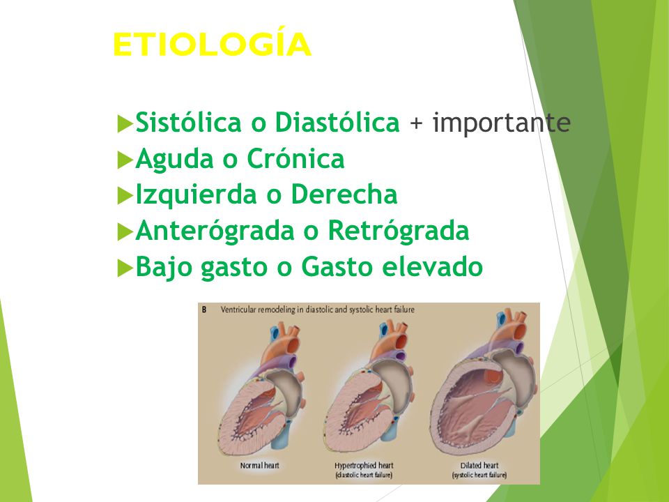 ETIOLOGÍA Sistólica o Diastólica + importante Aguda o Crónica