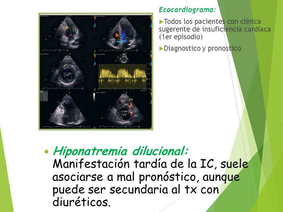 Ecocardiograma: Todos los pacientes con clínica sugerente de insuficiencia cardíaca (1er episodio)