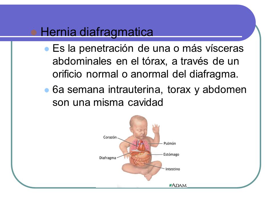 Hernia diafragmatica Es la penetración de una o más vísceras abdominales en el tórax, a través de un orificio normal o anormal del diafragma.