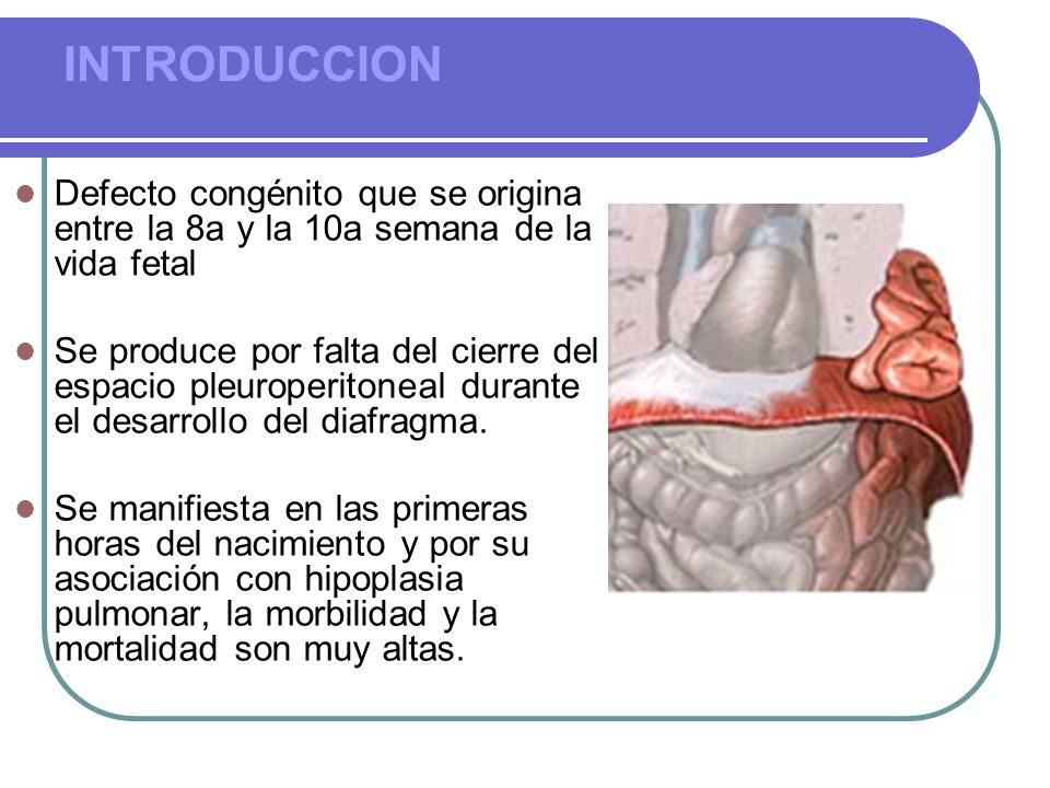INTRODUCCION Defecto congénito que se origina entre la 8a y la 10a semana de la vida fetal.