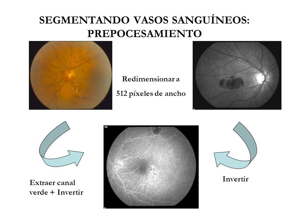 SEGMENTANDO VASOS SANGUÍNEOS: PREPOCESAMIENTO