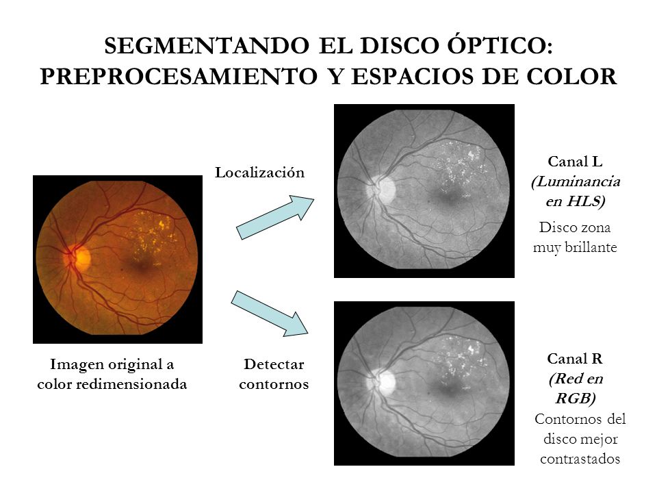 SEGMENTANDO EL DISCO ÓPTICO: PREPROCESAMIENTO Y ESPACIOS DE COLOR