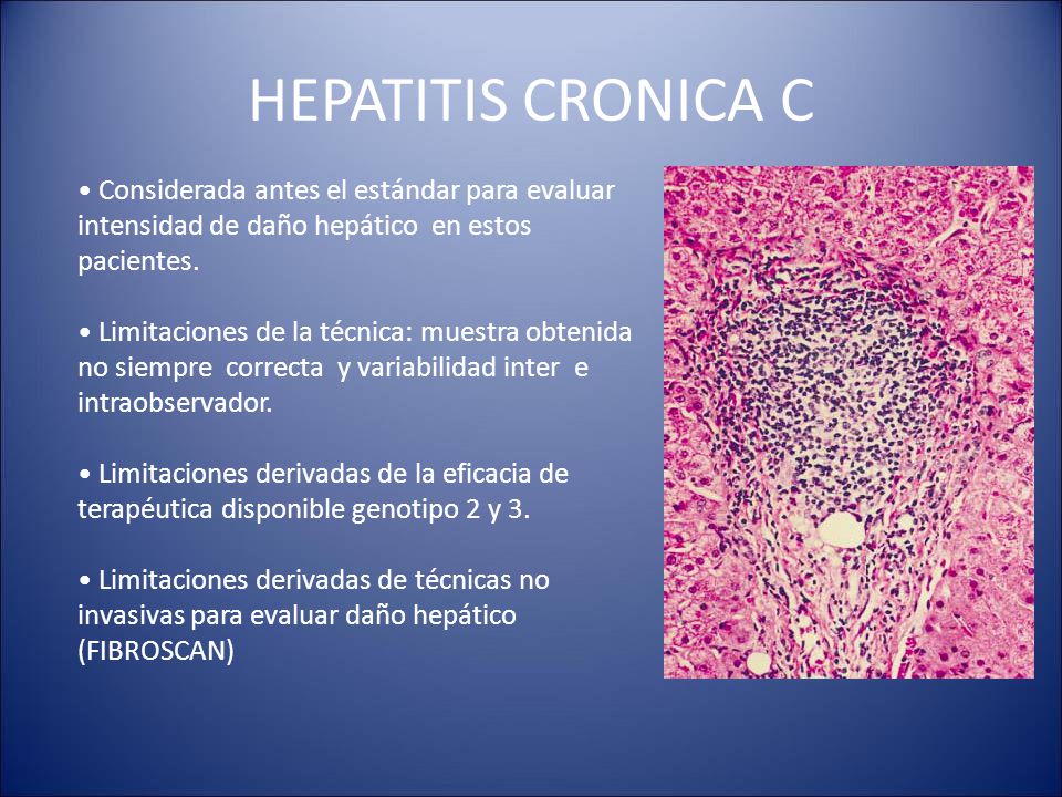 HEPATITIS CRONICA C Considerada antes el estándar para evaluar intensidad de daño hepático en estos pacientes.