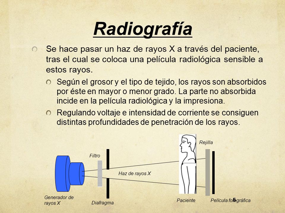 Radiografía Se hace pasar un haz de rayos X a través del paciente, tras el cual se coloca una película radiológica sensible a estos rayos.