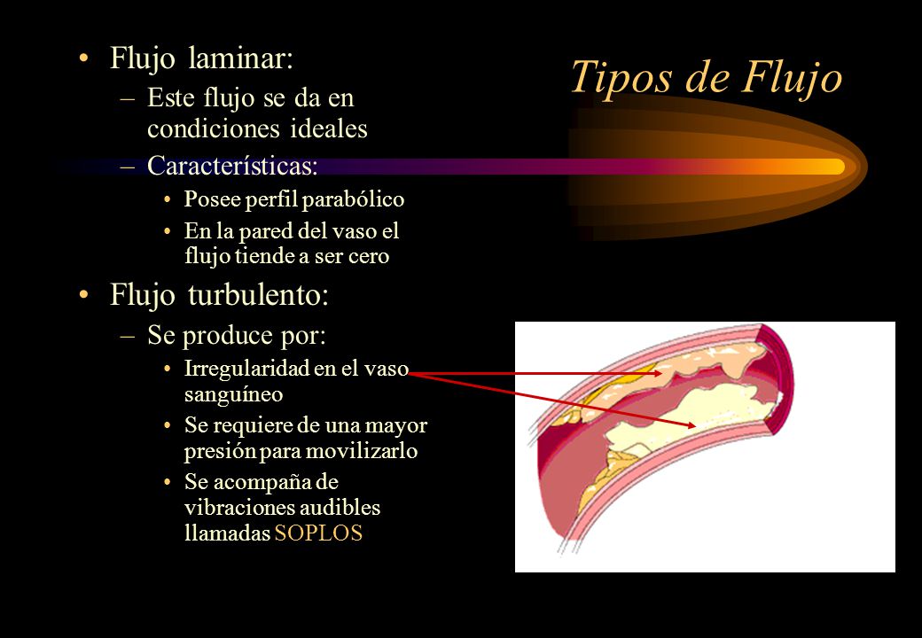 Tipos de Flujo Flujo laminar: Flujo turbulento: