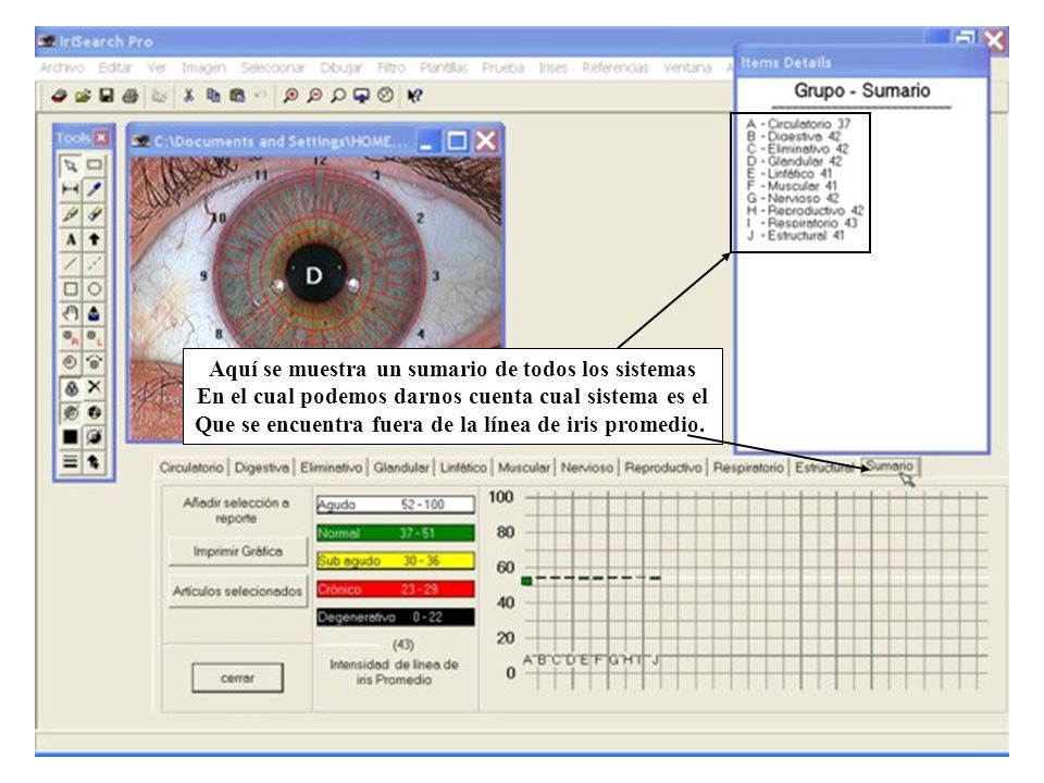 Aquí se muestra un sumario de todos los sistemas