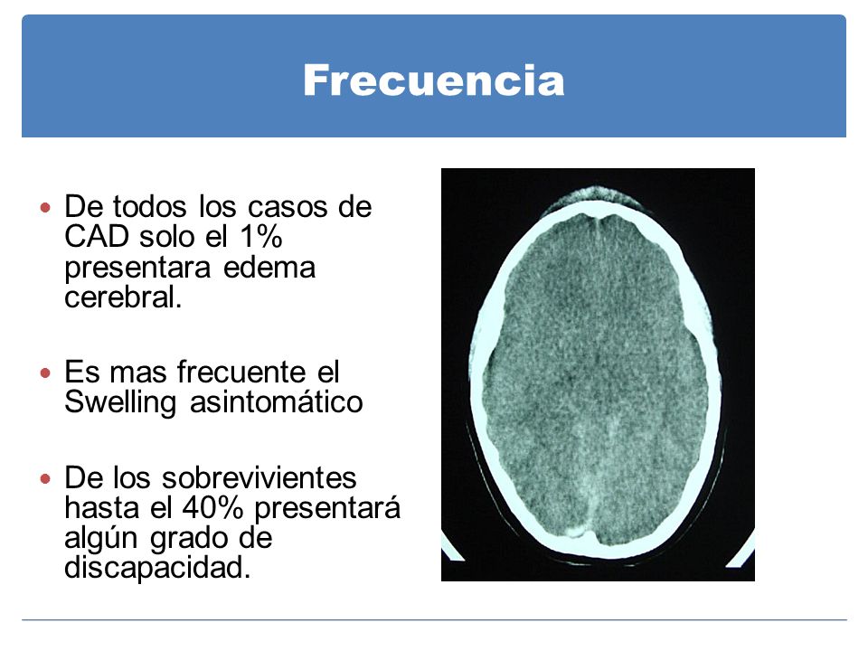 Frecuencia De todos los casos de CAD solo el 1% presentara edema cerebral. Es mas frecuente el Swelling asintomático.