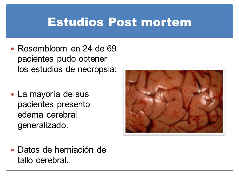Estudios Post mortem Rosembloom en 24 de 69 pacientes pudo obtener los estudios de necropsia: