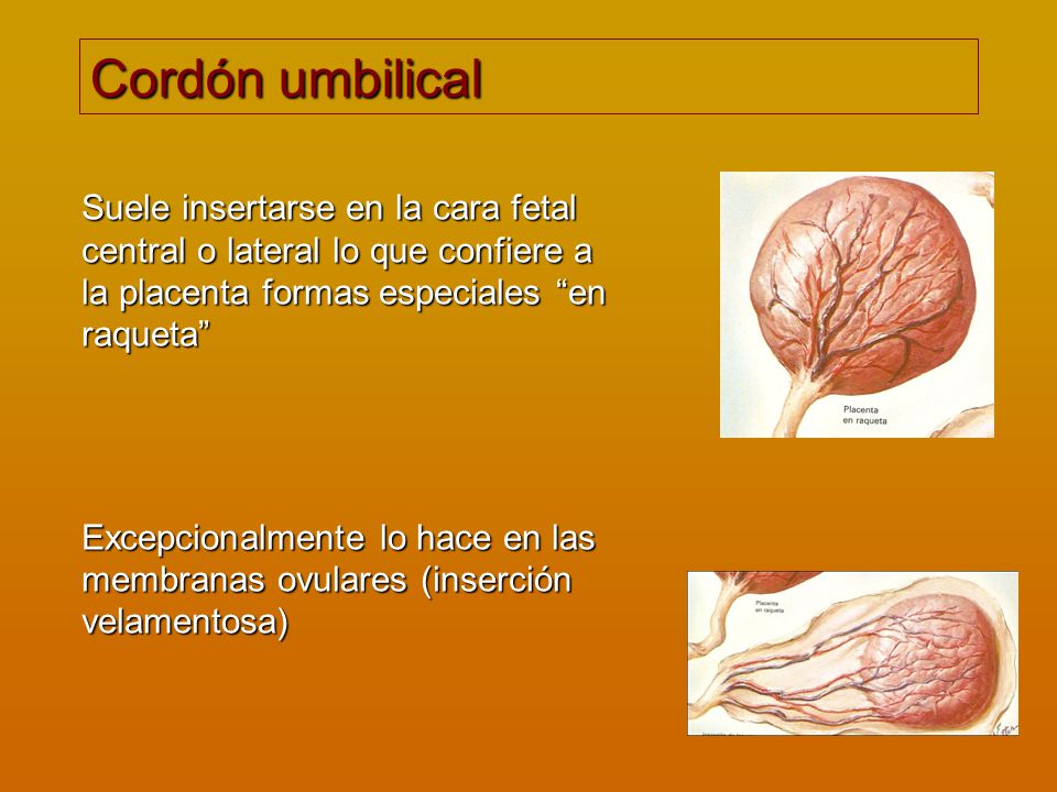 Cordón umbilical Suele insertarse en la cara fetal central o lateral lo que confiere a la placenta formas especiales en raqueta