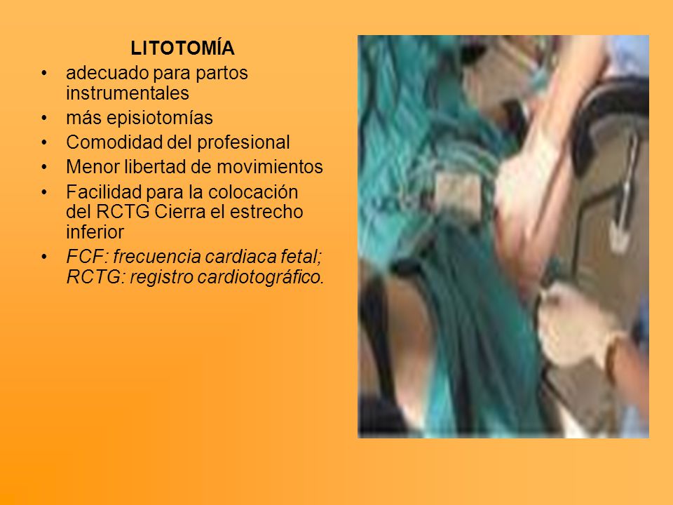 LITOTOMÍA adecuado para partos instrumentales. más episiotomías. Comodidad del profesional. Menor libertad de movimientos.
