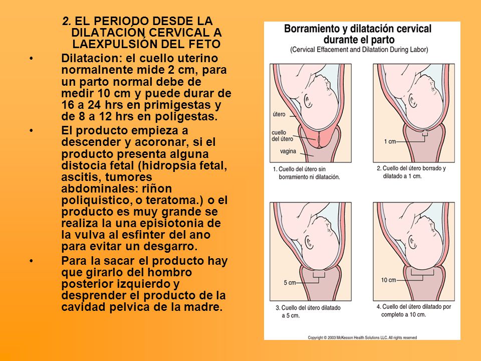 2. EL PERIODO DESDE LA DILATACIÓN CERVICAL A LAEXPULSIÓN DEL FETO