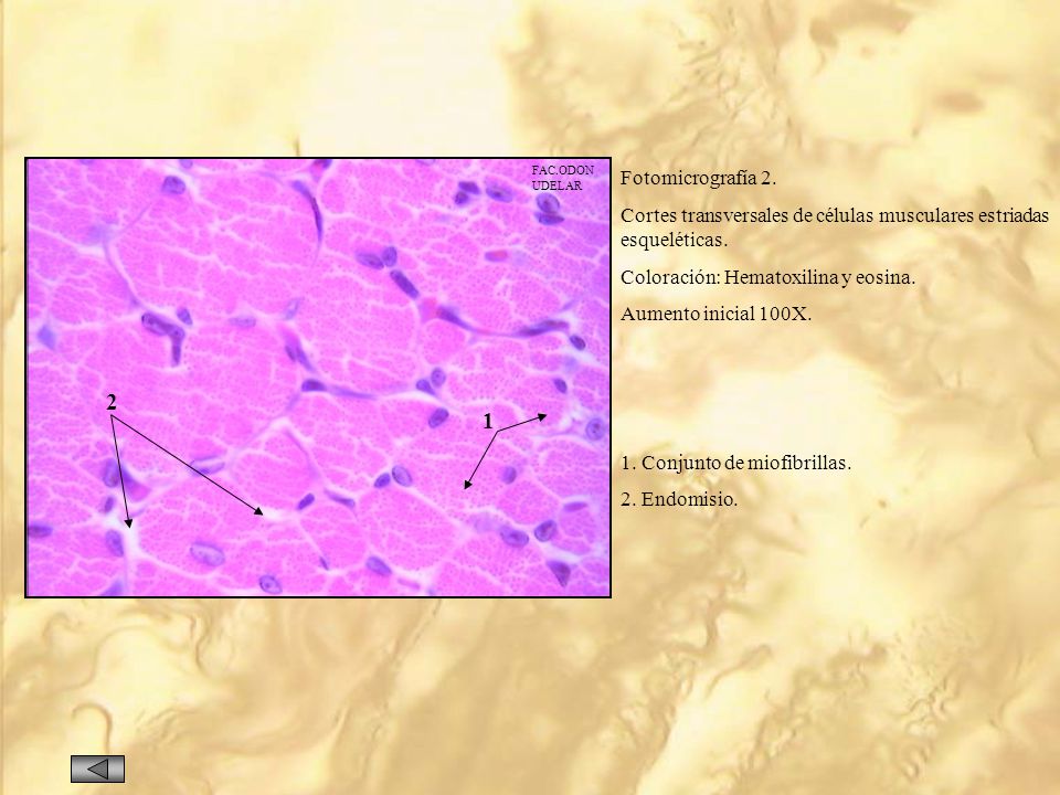 FAC.ODON UDELAR. Fotomicrografía 2. Cortes transversales de células musculares estriadas esqueléticas.