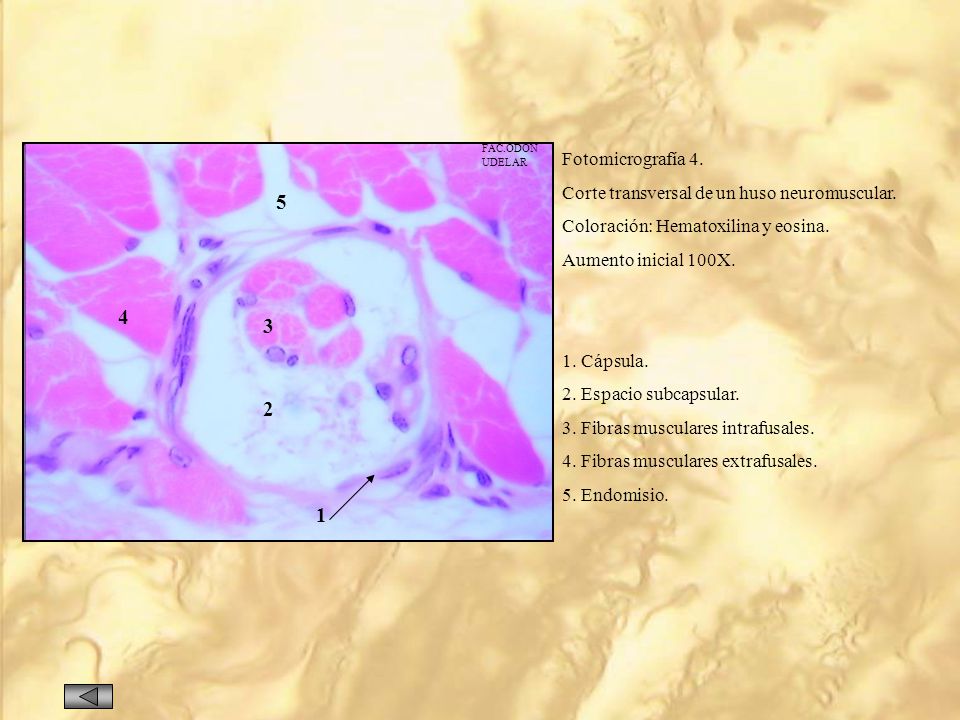 FAC.ODON UDELAR. Fotomicrografía 4. Corte transversal de un huso neuromuscular. Coloración: Hematoxilina y eosina.