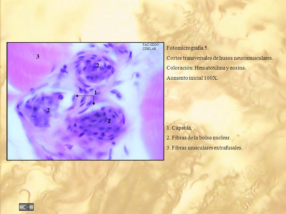 FAC.ODON UDELAR. Fotomicrografía 5. Cortes transversales de husos neuromusculares. Coloración: Hematoxilina y eosina.