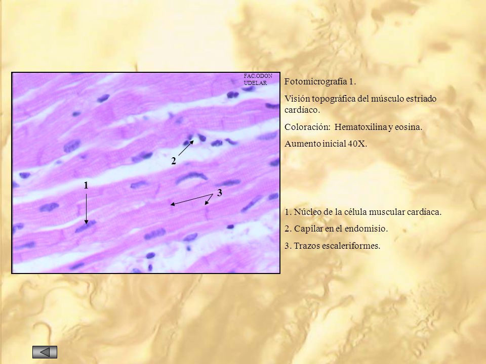 FAC.ODON UDELAR. Fotomicrografía 1. Visión topográfica del músculo estriado cardíaco. Coloración: Hematoxilina y eosina.
