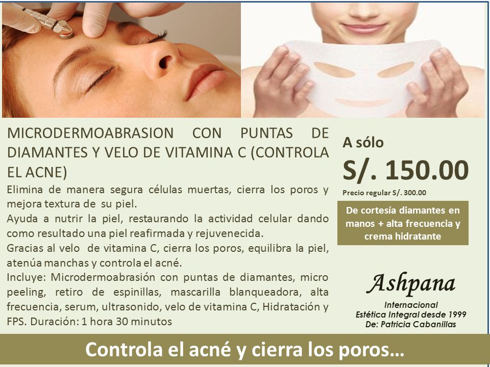 S/ Ashpana Controla el acné y cierra los poros…