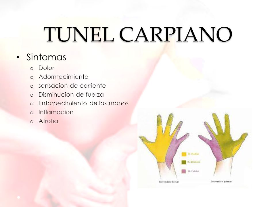 TUNEL CARPIANO Sintomas Dolor Adormecimiento sensacion de corriente