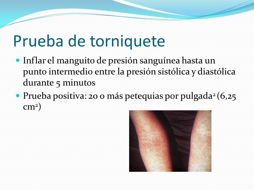 Prueba de torniquete Inflar el manguito de presión sanguínea hasta un punto intermedio entre la presión sistólica y diastólica durante 5 minutos.