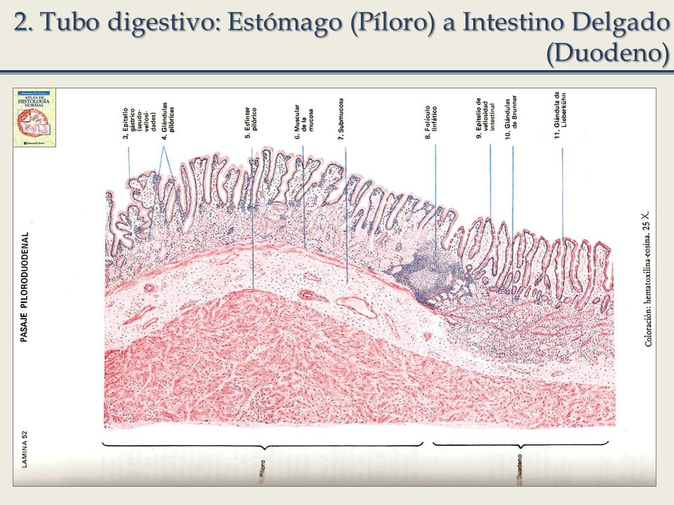 2. Tubo digestivo: Estómago (Píloro) a Intestino Delgado (Duodeno)