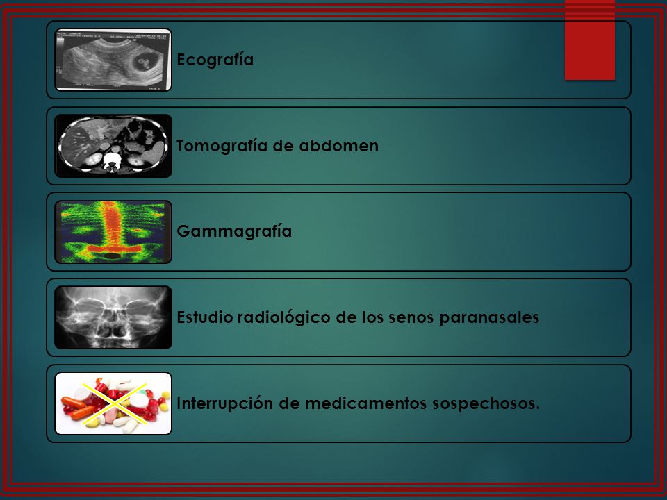 Ecografía Tomografía de abdomen. Gammagrafía. Estudio radiológico de los senos paranasales.