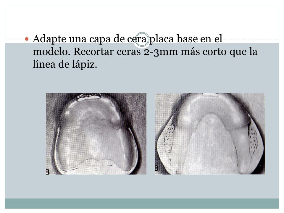 Adapte una capa de cera placa base en el modelo