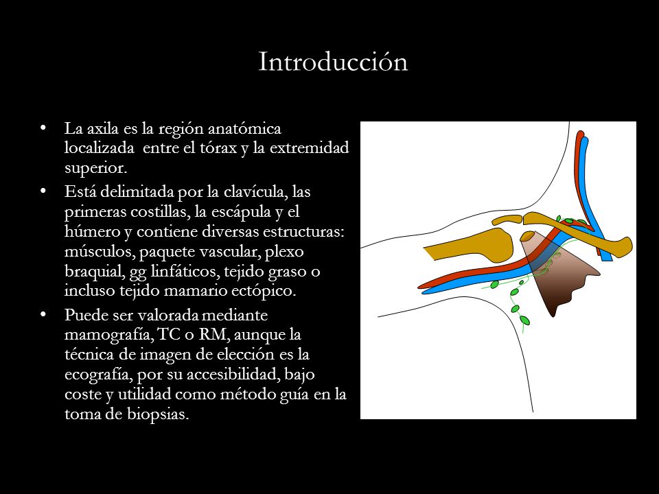 Introducción La axila es la región anatómica localizada entre el tórax y la extremidad superior.