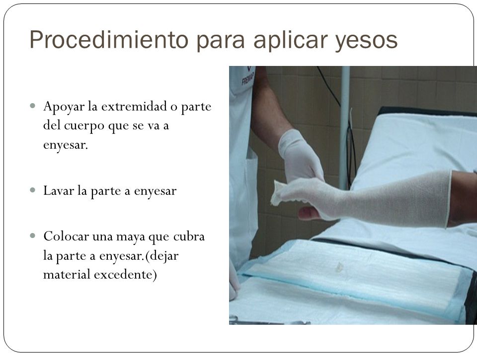 Procedimiento para aplicar yesos