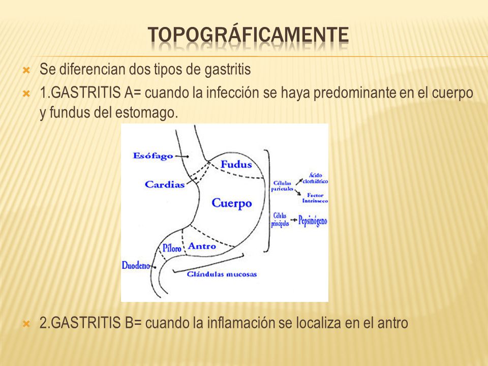 topográficamente Se diferencian dos tipos de gastritis