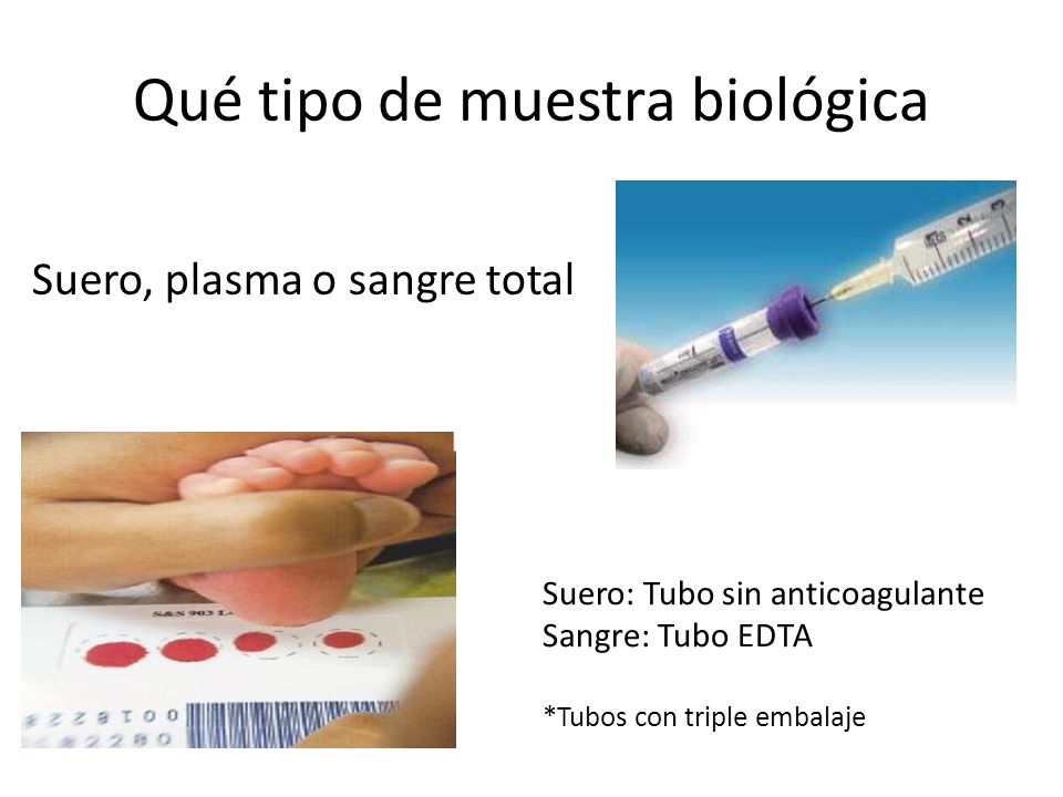 Qué tipo de muestra biológica