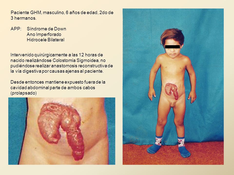 Paciente GHM, masculino, 6 años de edad, 2do de 3 hermanos.
