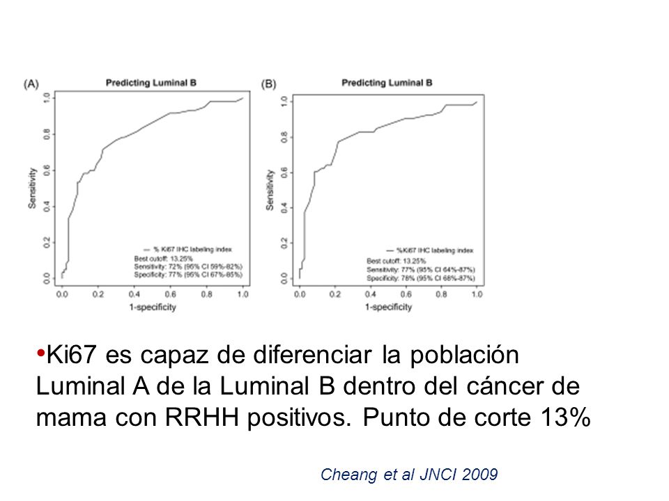 Ki67 es capaz de diferenciar la población Luminal A de la Luminal B dentro del cáncer de mama con RRHH positivos. Punto de corte 13%
