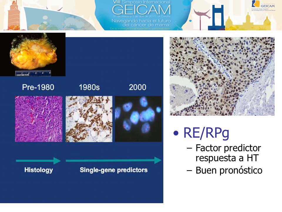 RE/RPg Factor predictor respuesta a HT Buen pronóstico